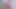 Stockinged esmerler thresssome ile doktor
