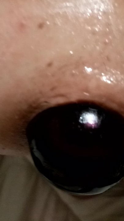 Anal