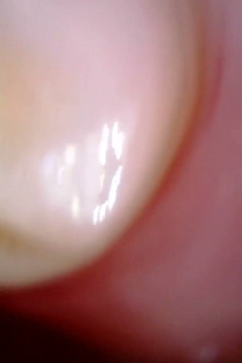 Medical Endoscope Oral Exam: Gummy Chewing, Extreme Teeth & Tongue Macro