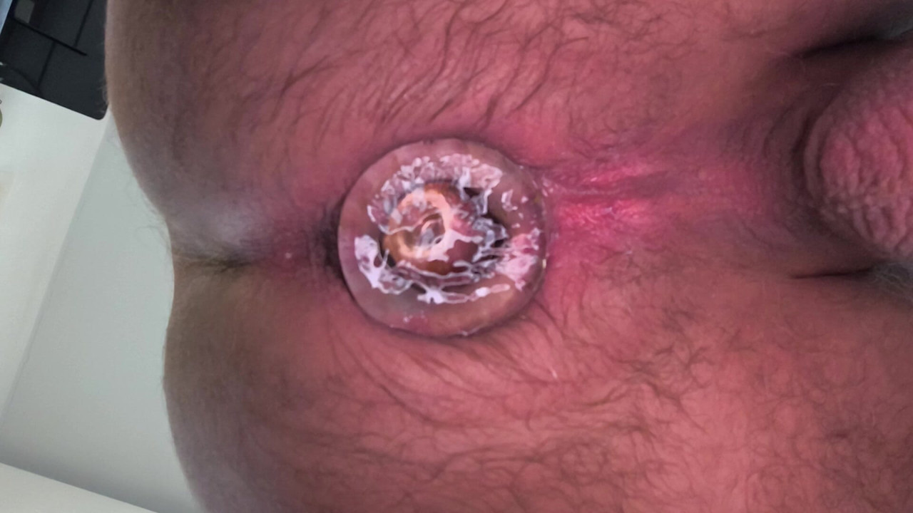 Introducerea/sortantul anal cu dop 2