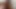 LizzyYum January 30 2024 I.C.E.1 Post Op Orgasm Pussy anal Masturbation Teasing