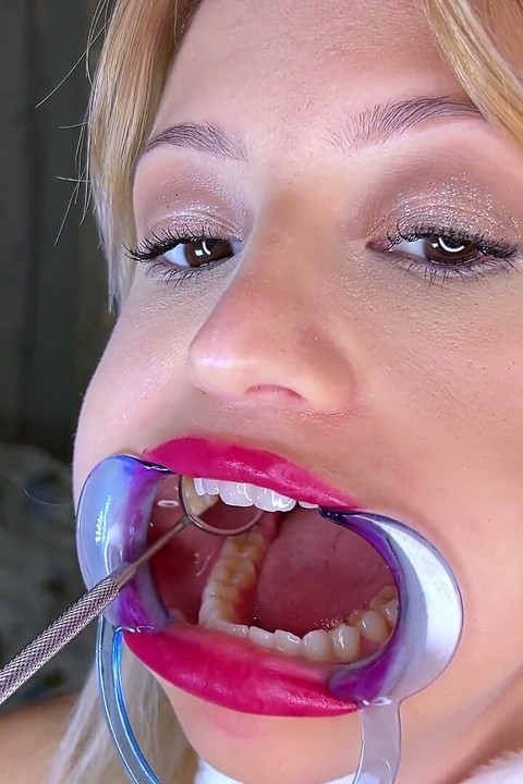 Mouth Retractor Teeth Examination
