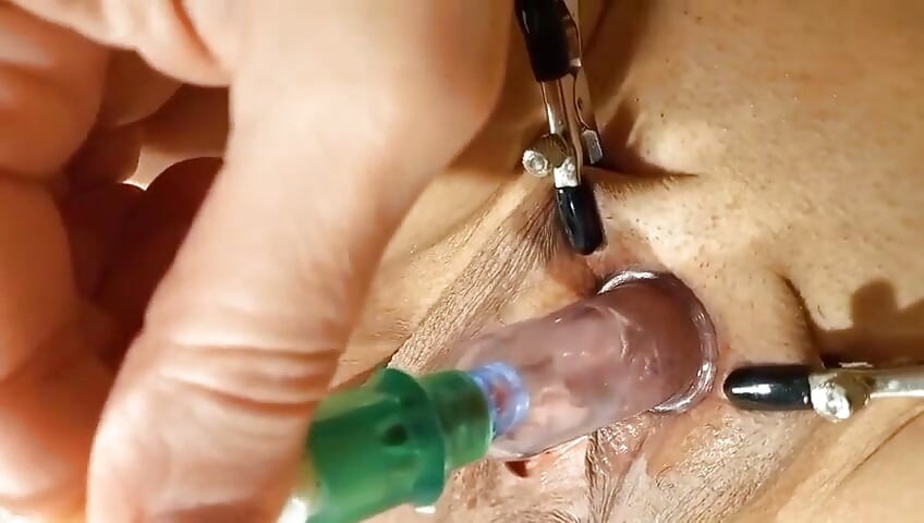 A Pump, a Vibrator, and the Clitoris Bring Her to Orgasm