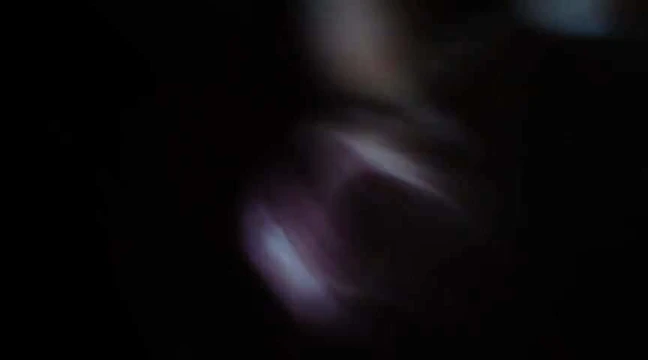 drkanje