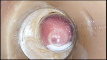 Pratinjau video