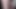 ボールバスターUsusa-クリップ102
