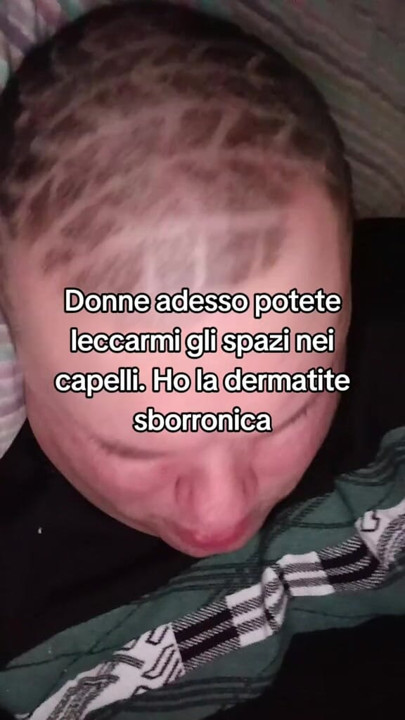 The tik tok master suffers from dermatitis