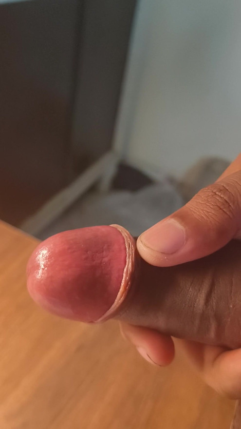 My Beautiful Dick