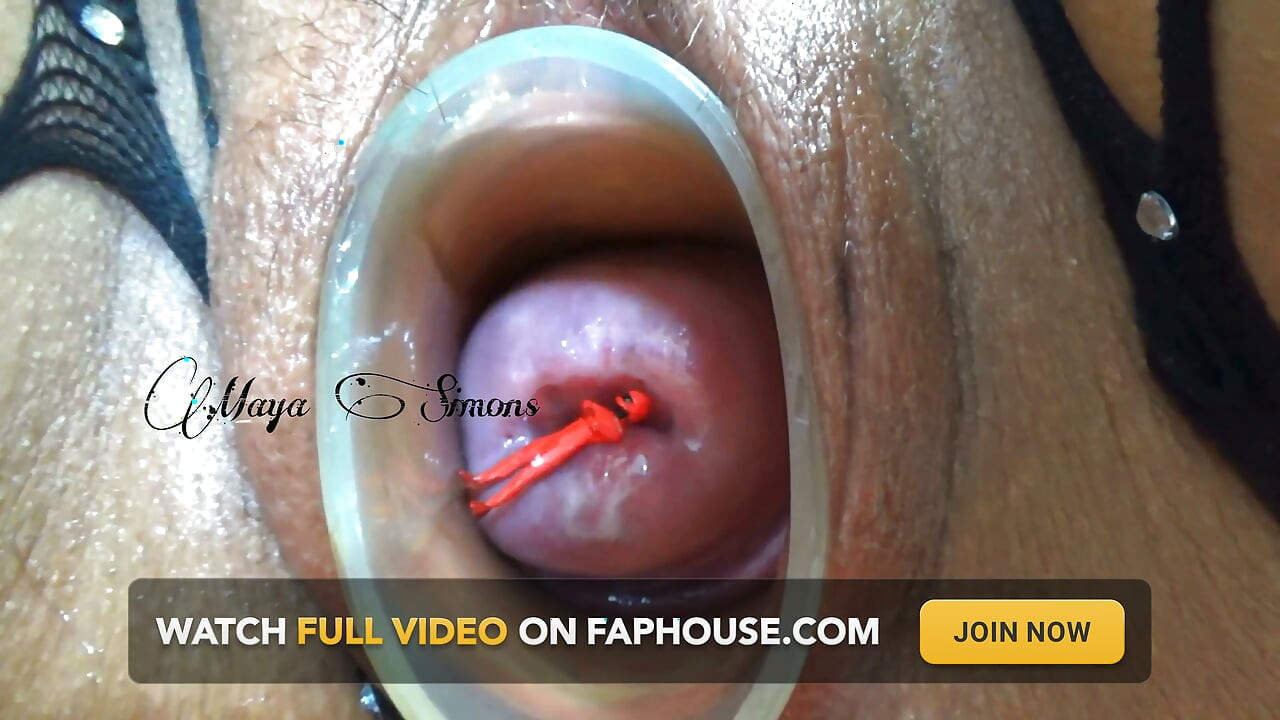 This Is What My Cervix Looks Like After a Year Without Seeing It