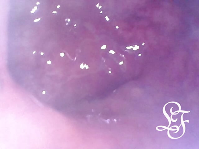 Exploring the Depths of my Ass with the Minicam!
