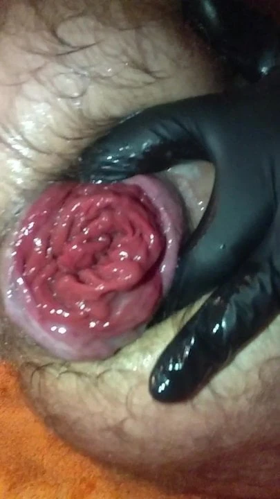 Rosebud and gape extended