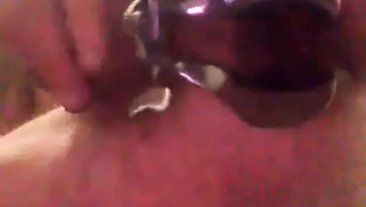 anal