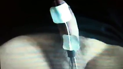Electroshock