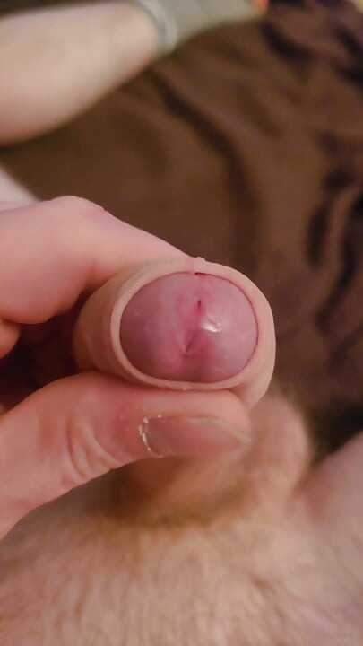 Penis Zeigen