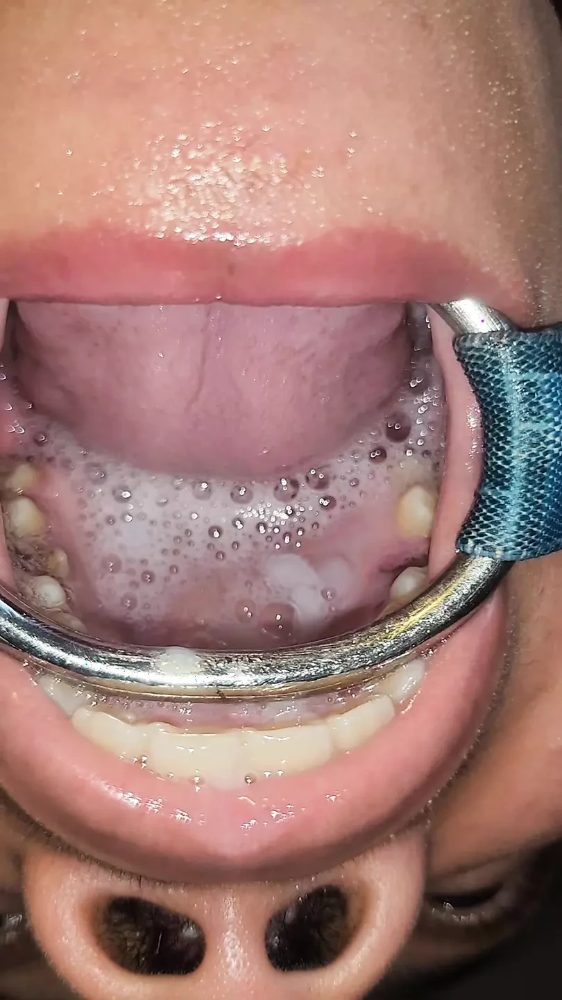 Throat Fuck with Open Mouth Gag and Spit Cum in Mouth