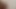 Hint TikTok yıldız lanet zor bölüm 2