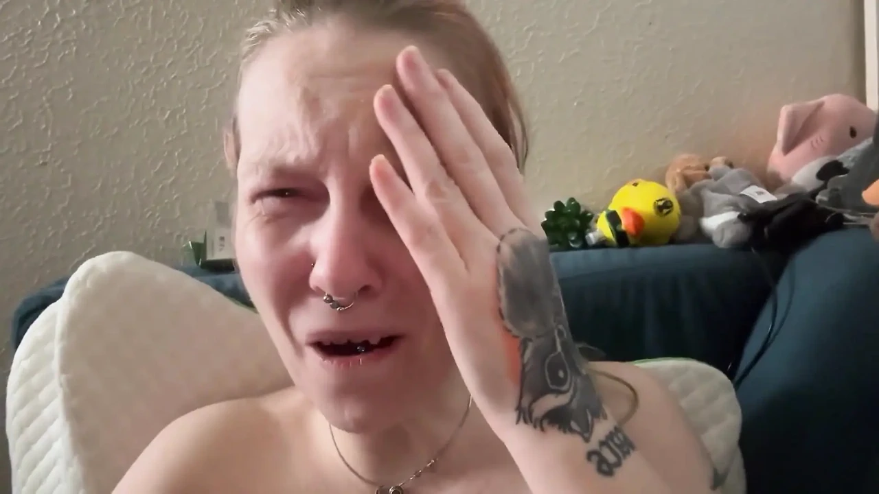 伤害我自己的擦伤