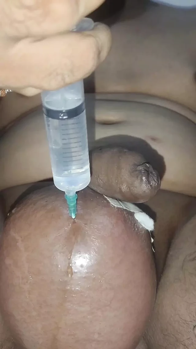 2 litre saline injection