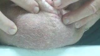 Penectomy mit pee Dildo
