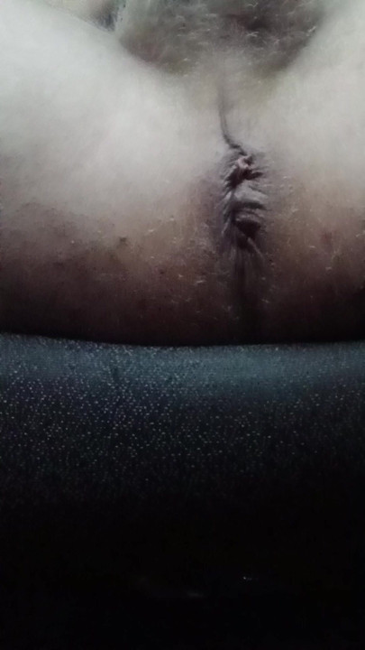 anus2