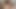 Mistress Giving Hubby Intense Prostate Massage With Huge Dildo, Urethral Sounding
