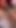 When Dilation Goes Crazy FPOV Trans Post OP Teaser