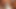 VISIT-X Redhead hat kein Loch mehr im Vierer FMMM frei