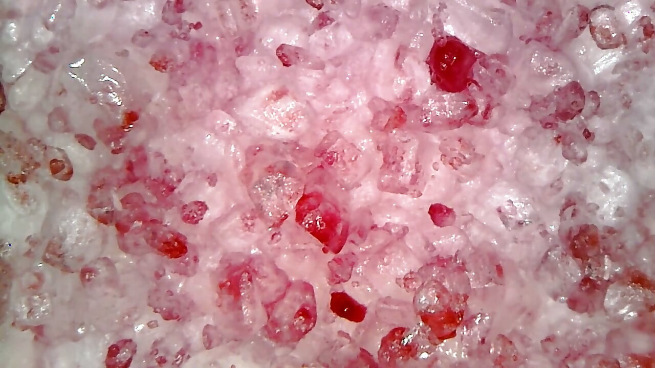 Medizinische Endoskopische Orale Untersuchung: Kauen Von Gummi, Extreme Zähne & Zunge Makro