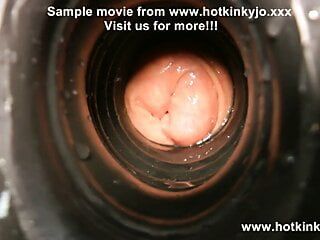 Hotkinkyjo 99厘米深的假阳具肛门插入，脱垂等