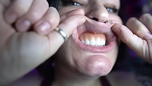 Mundtour mit Prothese in