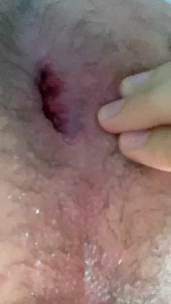 Gay teen asshole play