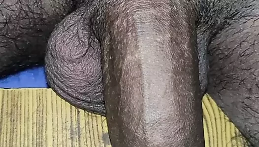 Penis şakayık ve fimosis 2