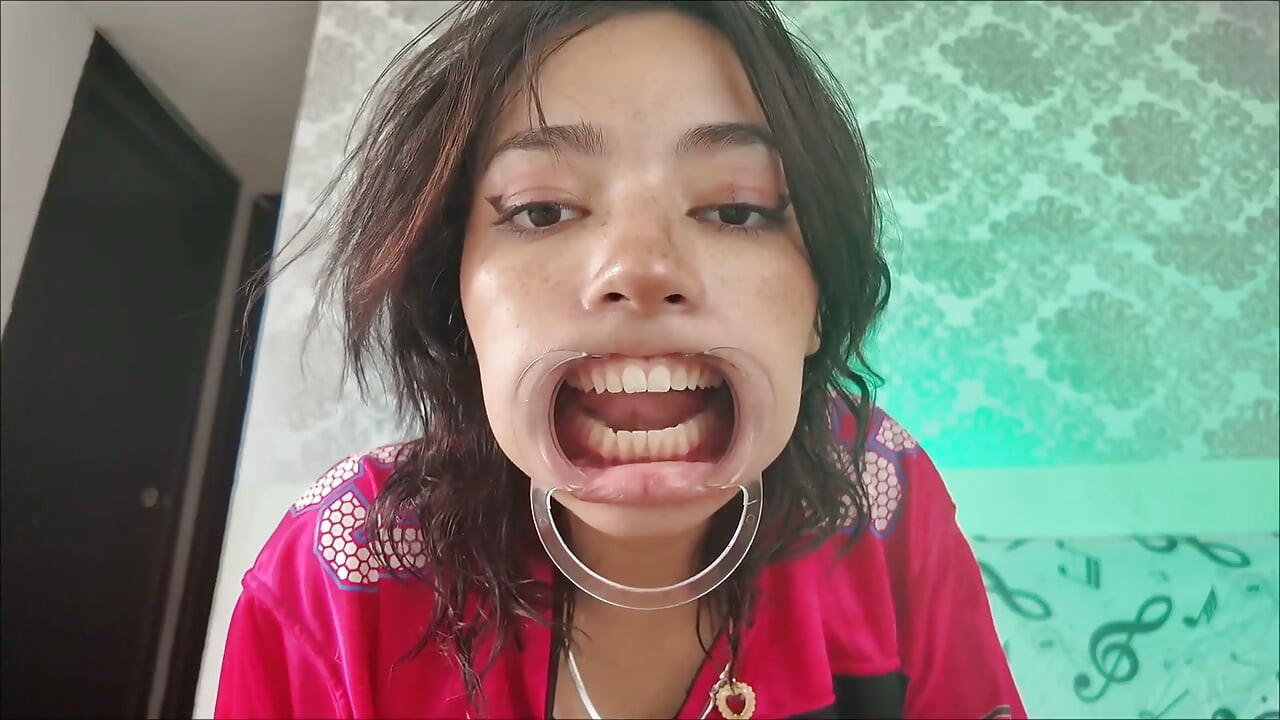 Má bị kéo ra ngoài răng lộ ra