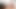 A 20-year-old Girl Who Is Insanely Sexually Frigid in Bed