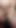 Hairy belly ftm gives self injection into thick thigh.