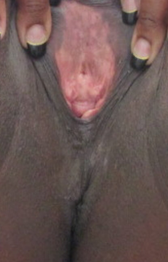 Stor svart hårete gapende fitte som lekker piss, stor bbw fitte som gaper åpen klar for alle kukene dine mmmm