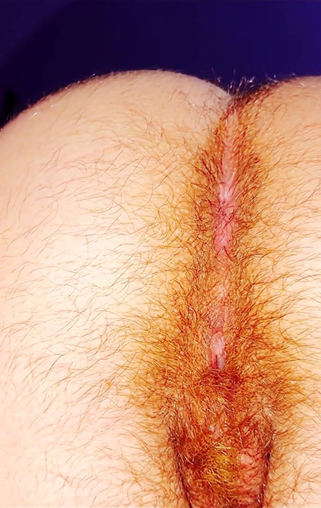 Close-up of hairy butt during my pregnancy
