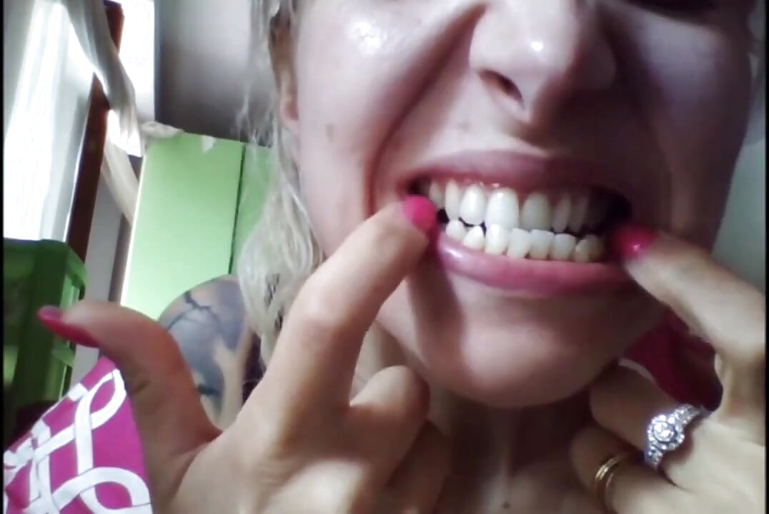 Hermosa cara, pero dientes podridos!