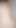 Köstlich wunde anal