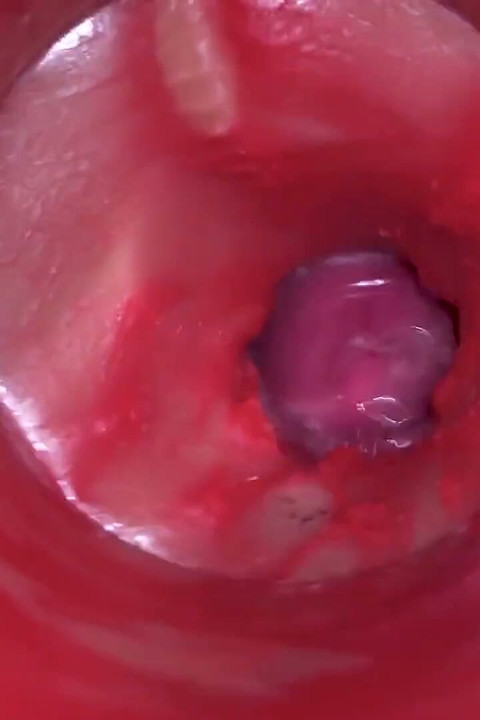 Camera Inside Pussy - Powerfull Cum in Pussy! Best Internal Asmr