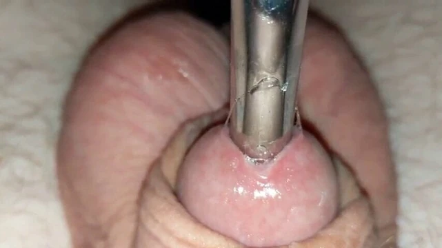 fisting