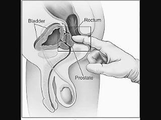 Como ordenhar sua próstata por conta própria