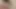 Rosebud Prolapse Tease - Pulsing Anal Bloom Exposed