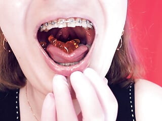 Asmr Eating Jelly Bears With Braces by Arya Grander