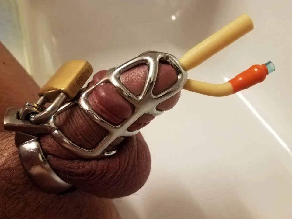 Tunneled Vs Non Tunneled Catheter Key Differences Explained Free Hot 