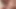 Breast Parts Vol 89: Bitch I Miss Your BNT's Edition V1