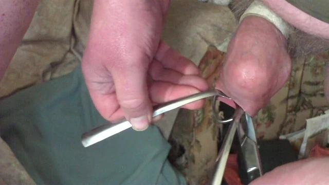 Foreskin with a table tennis ball, scissors, two spoons
