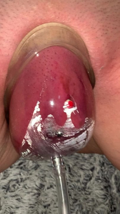 Huge pussy pump