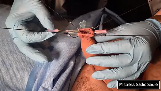 Needle CBT at It's Finest.