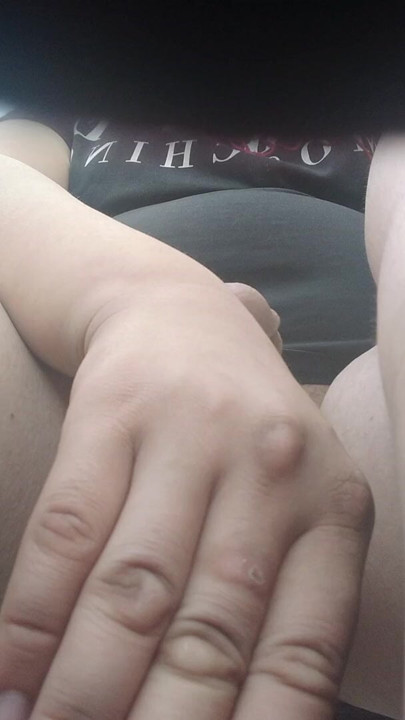 Fap